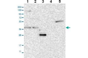 Western blot analysis of Lane 1: RT-4 Lane 2: U-251 MG Lane 3: Human Plasma Lane 4: Liver Lane 5: Tonsil with ST3GAL6 polyclonal antibody .