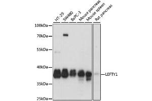 Western blot analysis of extracts of various cell lines, using LEFTY1 antibody. (LEFTY1 Antikörper)