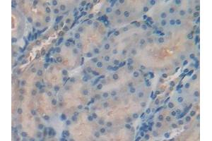 DAB staining on IHC-P; Samples: Rat Kidney Tissue (TIMP2 Antikörper  (AA 27-220))