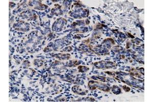 Immunohistochemical staining of paraffin-embedded Human breast tissue using anti-CRYM mouse monoclonal antibody. (CRYM Antikörper)