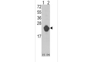 Western blot analysis of IL1RN using rabbit polyclonal IL1RN Antibody using 293 cell lysates (2 ug/lane) either nontransfected (Lane 1) or transiently transfected with the IL1RN gene (Lane 2).