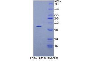 SDS-PAGE (SDS) image for Keratin 81 (KRT81) (AA 266-422) protein (His tag) (ABIN1878868)