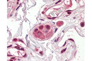 Anti-Groucho antibody IHC of human colon, submucosal plexus. (AES Antikörper  (AA 79-91))
