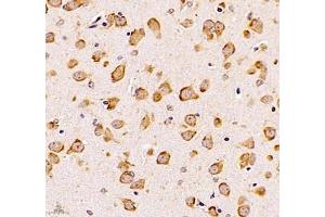 Immunohistochemistry of paraffin embedded mouse brain using UQCC (ABIN7076094) at dilution of 1: 1000 (400x lens) (Ubiquinol-Cytochrome C Reductase Complex Chaperone (UQCC) Antikörper)