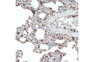 Immunohistochemistry of paraffin-embedded rat lung using SR-B2/SR-B2/LIMPII Rabbit mAb (ABIN7270157) at dilution of 1:100 (40x lens). (SCARB2 Antikörper)