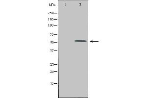 Western blot analysis of extracts from HepG2 cells, using UEVLD antibody. (UEVLD Antikörper  (N-Term))