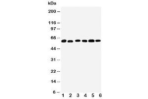 Western blot testing of Monoamine Oxidase B antibody and Lane 1:  mouse liver (Monoamine Oxidase B Antikörper  (N-Term))