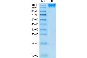Human CD96 on Tris-Bis PAGE under reduced condition. (CD96 Protein (CD96) (AA 22-503) (mFc Tag))
