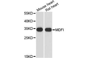 Western blot analysis of extracts of various cell lines, using MDFI antibody. (MDFI Antikörper)