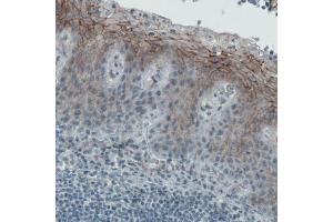 Immunohistochemical staining (Formalin-fixed paraffin-embedded sections) of human tonsil with OCLN monoclonal antibody, clone CL1567  shows membranous immunoreactivity in squamous epithelium cells. (Occludin Antikörper  (AA 282-415))