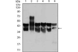 Western blot analysis using CDK2 antibody against Jurkat (1), HL-60 (2), K562 (3), A431 (4), HeLa (5), and NIH3T3 (6) cell lysate. (CDK2 Antikörper)