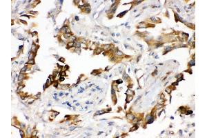 Immunohistochemistry (IHC) image for anti-Progesterone Receptor Membrane Component 1 (PGRMC1) (AA 67-102), (Middle Region) antibody (ABIN3043899)