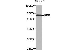 Western blot analysis of extracts of MCF-7 cell line, using PKR antibody. (EIF2AK2 Antikörper)