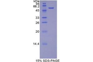 SDS-PAGE analysis of Rat bACE2 Protein. (BACE2 Protein)