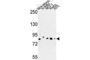 Western Blotting (WB) image for anti-Chondroitin Polymerizing Factor (CHPF) antibody (ABIN3004012)