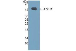 Detection of Recombinant MUC1, Human using Polyclonal Antibody to Mucin 1 (MUC1) (MUC1 Antikörper  (AA 1098-1255))