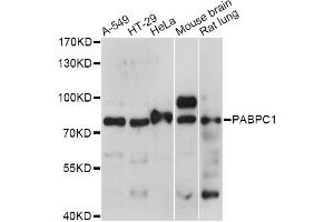 Western blot analysis of extracts of various cell lines, using PABPC1 antibody (ABIN6292221) at 1:1000 dilution. (PABP Antikörper)
