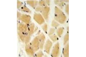 Immunohistochemistry (Paraffin-embedded Sections) (IHC (p)) image for anti-Glutamate-Cysteine Ligase, Modifier Subunit (GCLM) (AA 245-274), (C-Term) antibody (ABIN952478)