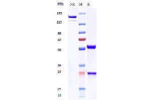 Anti-TREM1 / CD354 Reference Antibody (PY159) on SDS-PAGE under reducing (R) condition. (Rekombinanter TREM1 Antikörper)