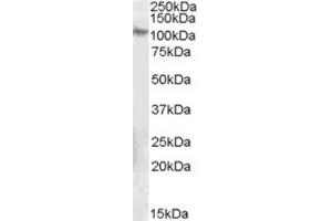 Western Blotting (WB) image for anti-Integrin beta 5 (ITGB5) (C-Term) antibody (ABIN2465852) (Integrin beta 5 Antikörper  (C-Term))