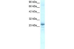 Human Heart; WB Suggested Anti-NKX2-8 Antibody Titration: 0. (NKX2-8 Antikörper  (C-Term))
