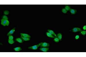 Immunofluorescent analysis of HepG2 cells using ABIN7170866 at dilution of 1:100 and Alexa Fluor 488-congugated AffiniPure Goat Anti-Rabbit IgG(H+L) (SMC4 Antikörper  (AA 406-501))
