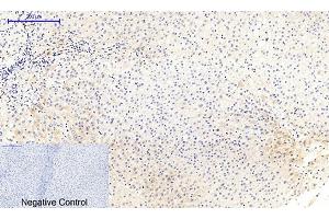 Immunohistochemical analysis of paraffin-embedded human liver tissue. (MEK1/2 Antikörper  (pSer218, pSer222))