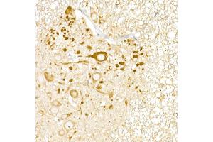 Immunohistochemistry (IHC) image for anti-Ubiquitin Specific Peptidase 18 (USP18) (AA 200-300) antibody (ABIN7271145)