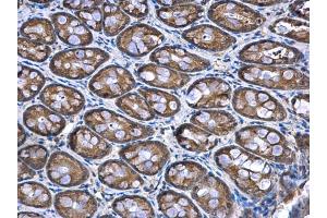 Immunohistochemistry (IHC) image for anti-NADH Dehydrogenase (Ubiquinone) 1 alpha Subcomplex, 12 (NDUFA12) (full length) antibody (ABIN2856686)