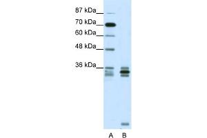 WB Suggested Anti-OLIG2 Antibody Titration: 0. (OLIG2 Antikörper  (C-Term))