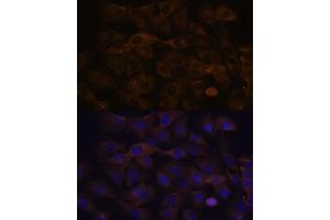 Immunofluorescence analysis of C6 cells using GRSF1 antibody (ABIN7267319) at dilution of 1:100. (GRSF1 Antikörper)