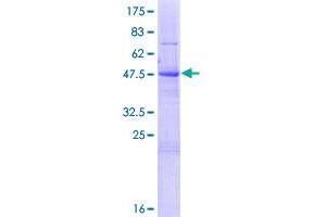 MAU2/KIAA0892 Protein (AA 1-218) (GST tag)