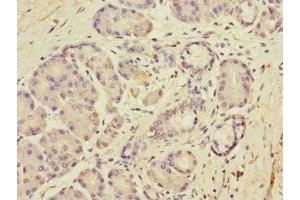 Immunohistochemistry of paraffin-embedded human pancreatic tissue using ABIN7150689 at dilution of 1:100 (DUOX1 Antikörper  (AA 1312-1551))