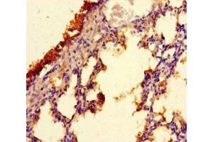 Immunohistochemistry of paraffin-embedded human lung tissue using ABIN7147754 at dilution of 1:100 (C9orf117 Antikörper  (AA 1-200))
