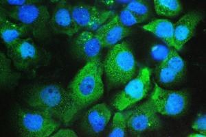 IF analysis of Galectin 3/LGALS3 using anti-Galectin 3/LGALS3 antibody (ABIN6719486). (Galectin 3 Antikörper  (AA 139-250))