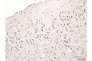 anti-CNIH2, CNIH3 (AA 25-120) antibody