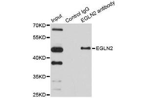Immunoprecipitation analysis of 150ug extracts of HeLa cells using 3ug EGLN2 antibody. (PHD1 Antikörper  (AA 150-250))