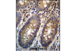 ASMTL Antibody (Center) (ABIN657160 and ABIN2846294) immunohistochemistry analysis in formalin fixed and paraffin embedded human colon tissue followed by peroxidase conjugation of the secondary antibody and DAB staining. (ASMTL Antikörper  (AA 231-259))