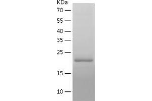 Western Blotting (WB) image for Peptidylprolyl Isomerase A (Cyclophilin A) (PPIA) (AA 1-164) protein (His tag) (ABIN7124347) (PPIA Protein (AA 1-164) (His tag))