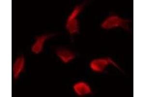 ABIN6275530 staining HepG2 by IF/ICC. (NEK5 Antikörper  (Internal Region))