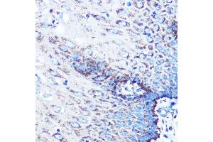 Immunohistochemistry of paraffin-embedded human esophageal using MMP3 Rabbit mAb (ABIN7268424) at dilution of 1:100 (40x lens). (MMP3 Antikörper)