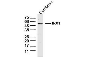 Mouse Cerebrum lysates probed with IRX1 Polyclonal Antibody, Unconjugated  at 1:300 dilution and 4˚C overnight incubation.