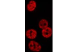 ABIN6276566 staining  Hela cells by IF/ICC. (NEDD8 Antikörper  (Internal Region))