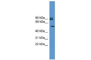 Western Blot showing OSBPL11 antibody used at a concentration of 1-2 ug/ml to detect its target protein. (OSBPL11 Antikörper  (C-Term))