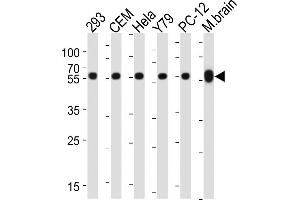 Western blot analysis of lysates from 293, CEM, Hela, Y79, rat PC-12 cell line, mouse brain tissue lysate(from left to right), using TBB5 Antibody (ABIN387758 and ABIN2838008). (TUBB Antikörper)