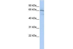 WB Suggested Anti-AIFM1  Antibody Titration: 0. (AIF Antikörper  (Middle Region))