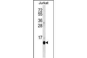 Western blot analysis in Jurkat cell line lysates (35ug/lane). (POLR2G Antikörper  (C-Term))