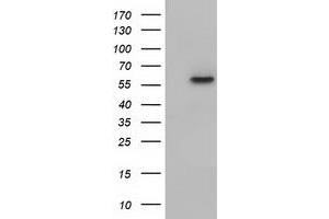Western Blotting (WB) image for anti-Kelch-Like 2, Mayven (KLHL2) (AA 1-100), (AA 494-593) antibody (ABIN1490546)