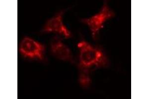 ABIN6275626 staining HepG2 cells by IF/ICC. (CCT6A Antikörper  (Internal Region))