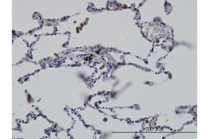 Immunostaining (ISt) image for anti-G Protein-Coupled Receptor Kinase Interactor 2 (GIT2) (AA 1-471) antibody (ABIN564230)